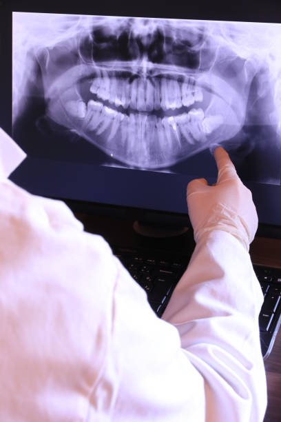 Best Emergency Denture Repair in Penn Valley, CA