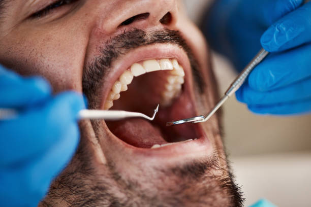 Best Emergency Denture Repair in Penn Valley, CA