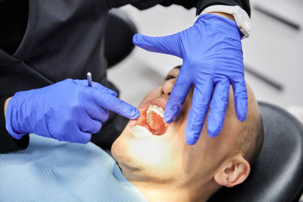 Best Knocked-Out Tooth (Avulsed Tooth) Treatment in Penn Valley, CA